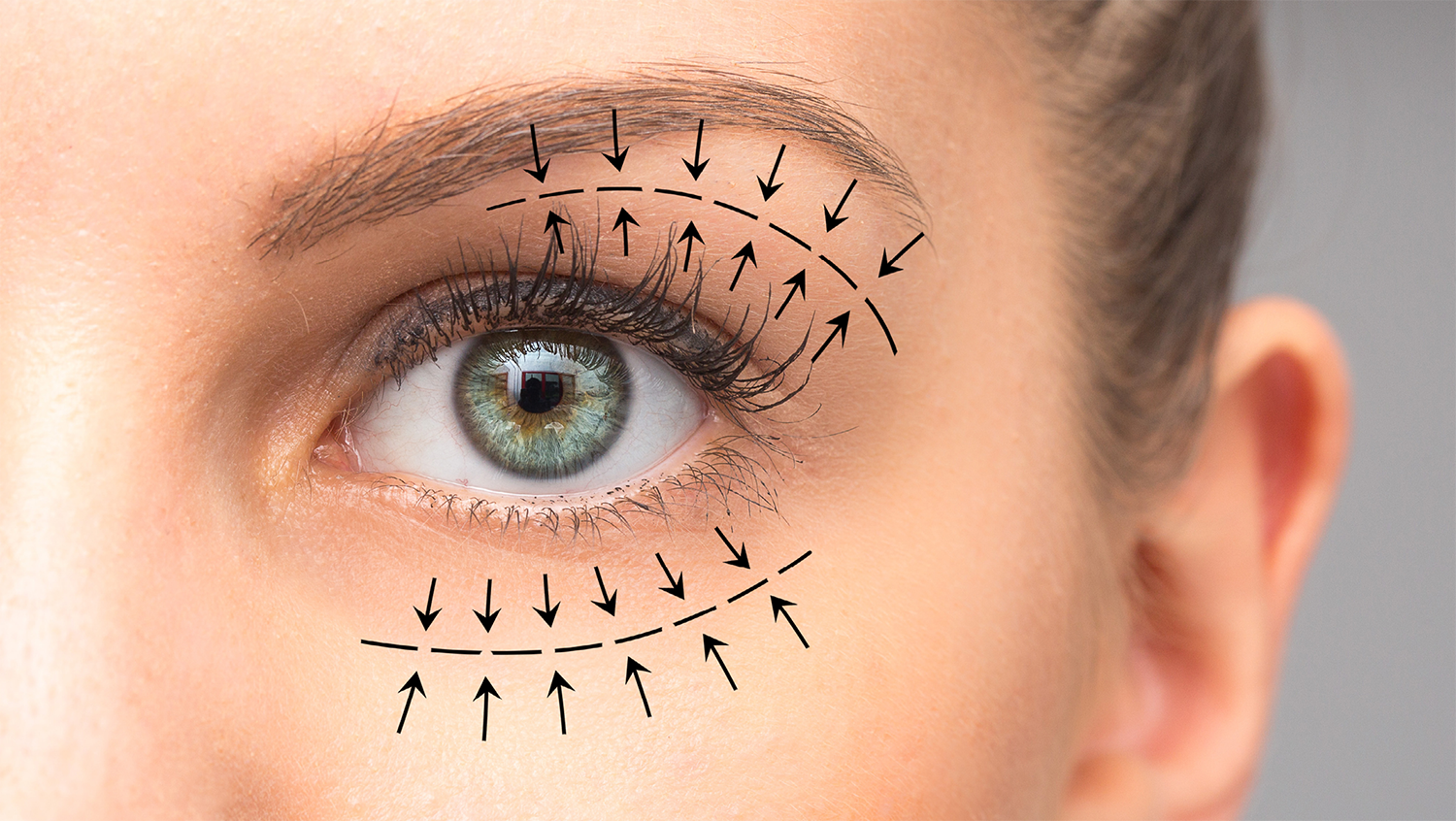 Plastic Surgery Dubai 