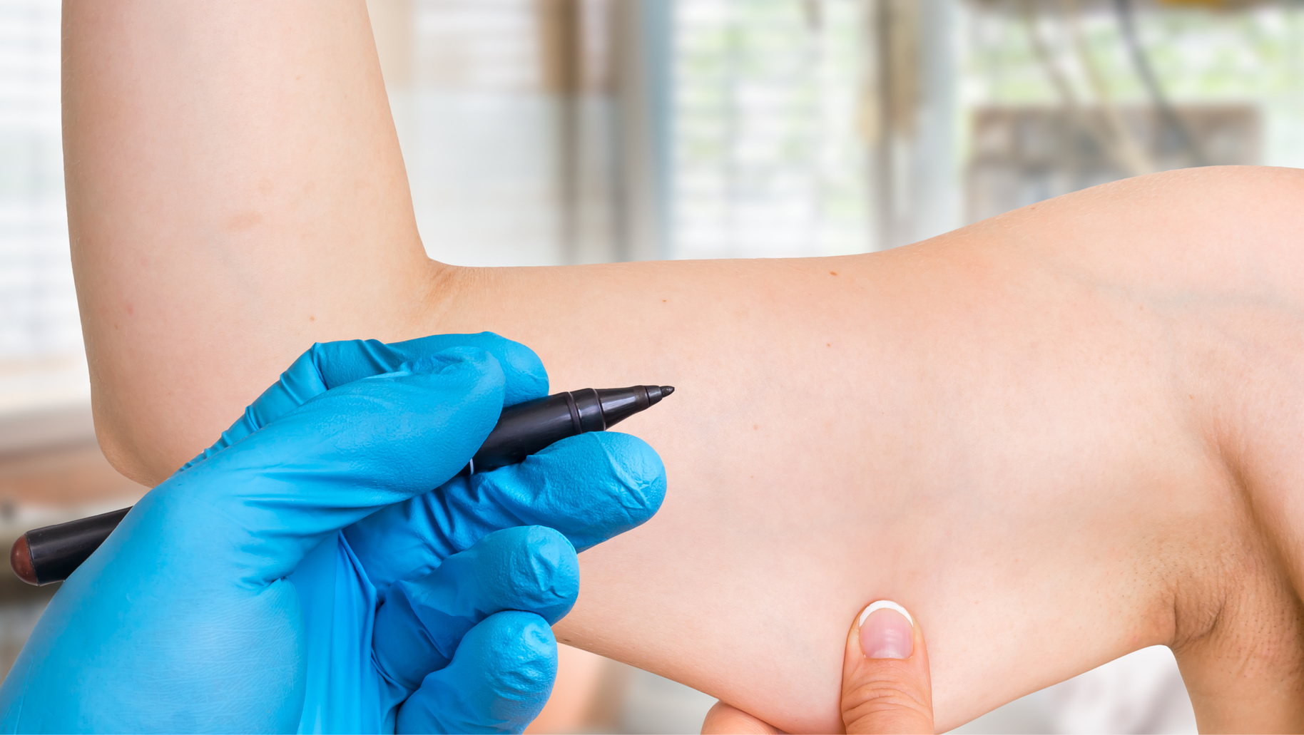Plastic Surgery Dubai