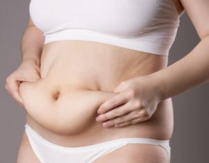 Tummy Tuck Dubai