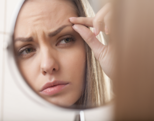 Blepharoplasty Dubai